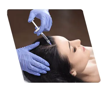 Mesotherapy Treatment for Hair Loss