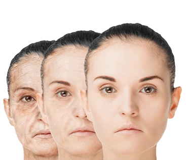 Anti Aging Treatment in Hyderabad